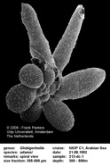 Globigerinella_adamsi.jpg